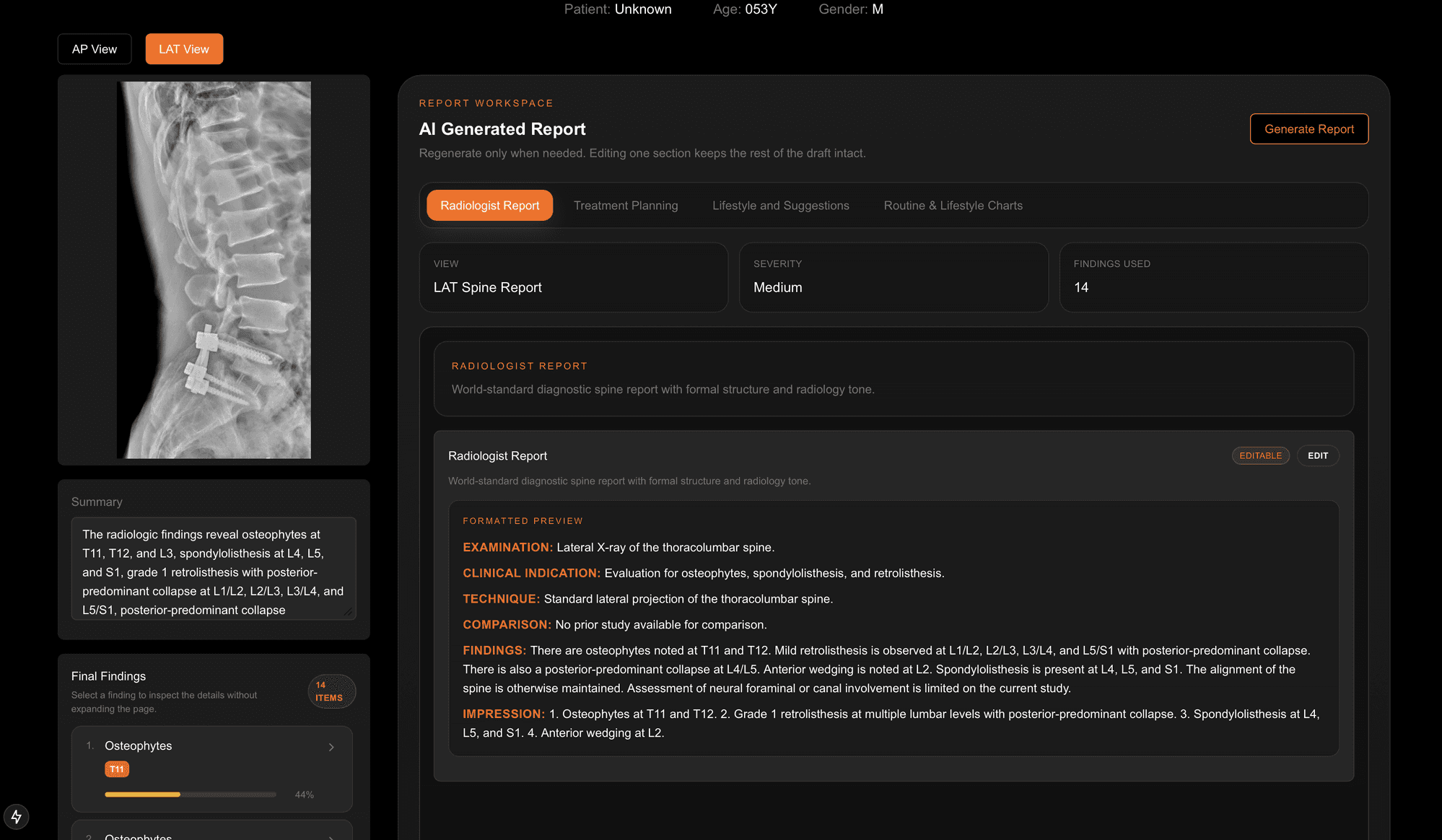 ClinIQ AI Generated Report workspace