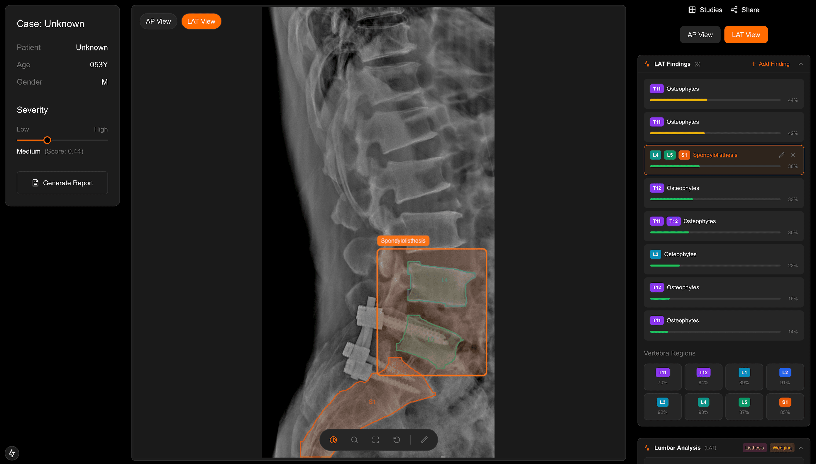 SpineVision diagnostic finding detection
