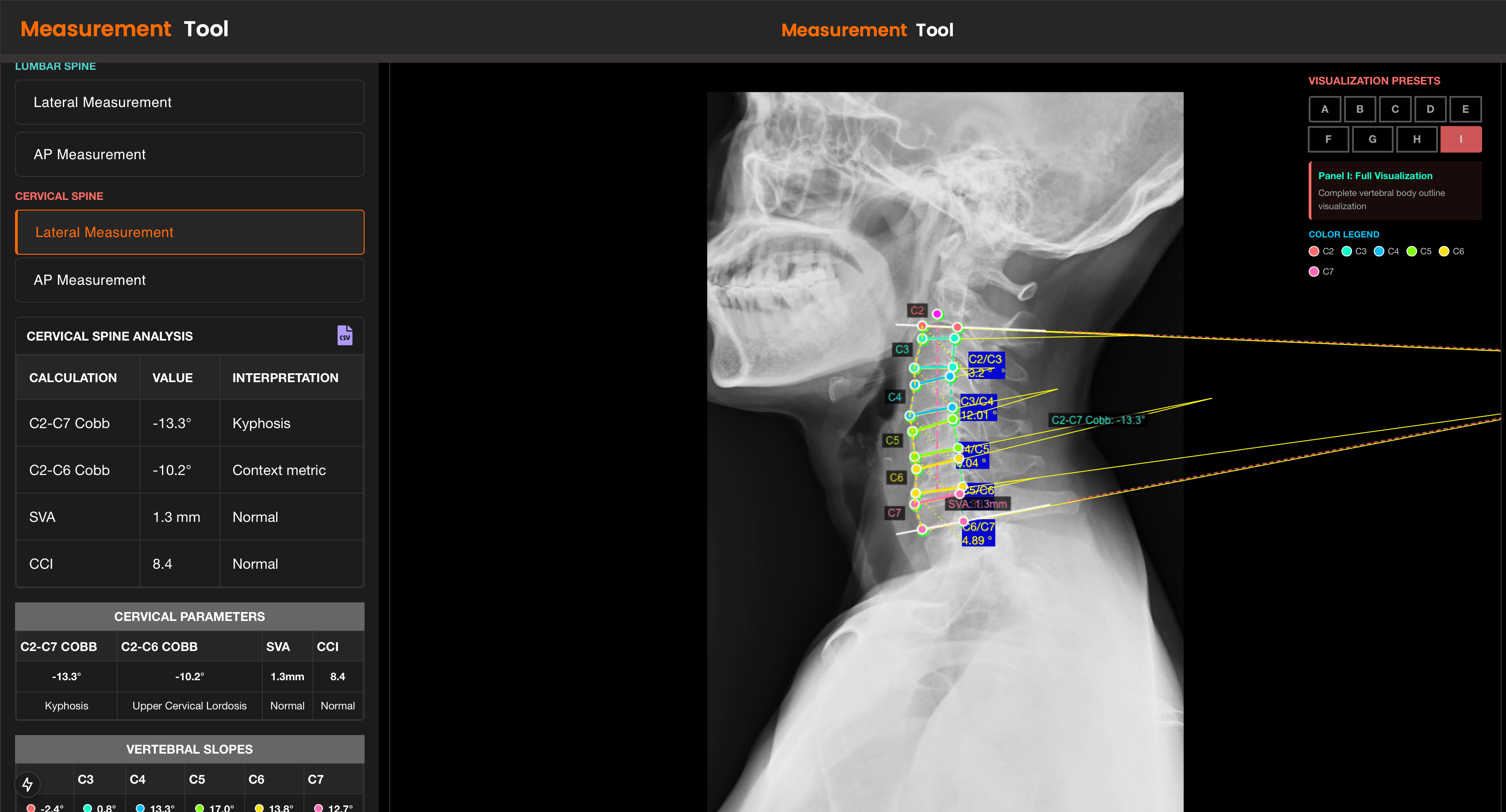 SpineVision cervical measurement workspace